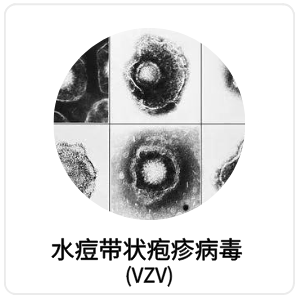 水痘带状疱疹病毒 (VZV)